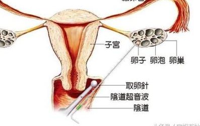 在北京做特需试管婴儿要多少钱？北京试管私立医院哪家好？