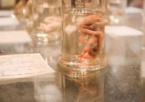 排卵障碍不容忽视，不孕大多是其原因！铜川市哪家医院擅长排卵障碍试管方案？