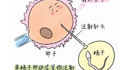 医院推荐！泰国三代试管婴儿哪家做？必选的三家医院！