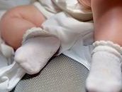 广西试管婴儿纳入医保是真的吗？