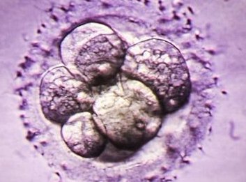 做试管婴儿需要具备的条件